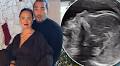 Beauty vlogger Chloe Morello announces she is expecting her first child