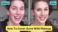 Acne be gone: the amazing artistry of YouTube make-up tutorials for bad skin | Makeup