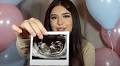 'The Ellen DeGeneres Show' Star Sophia Grace Brownlee Welcomes First Child