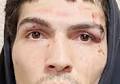 Police: Suspect in fatal assault in Altoona trains as boxer