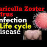 Varicella Zoster Virus Pathogenesis | Chickenpox Virus [ba3b34]