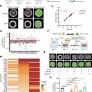 Human iPSC-based Modeling of Pulmonary Fibrosis Reveals p300/CBP Inhibition Suppresses Alveolar Transitional Cell State