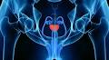 Elai Davicioni: Predicting Dose-Response to Prostate Cancer Radiotherapy