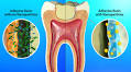 Basic2Breakthrough: A Dentist’s Journey to Save Your Teeth