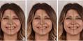 Assessment of dental students’ perceptions of facial and smile aesthetics: impact of gender, education level, and family background