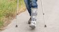 Walking just 2 weeks after ankle surgery is safe for many