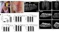Tensile force-induced PDGF-BB/PDGFRβ signals in periodontal ligament fibroblasts activate JAK2/STAT3 for orthodontic tooth movement