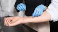 Smart Bandage Clears New Hurdle: Monitors Chronic Wounds in Human Patients