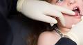 Letters: A dental crisis that could have been prevented