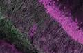 Intracortical Localization of a Promising Pain Biomarker