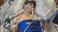 18-year-old recovering after horrific sledding accident