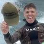 Shark attack victim shows horror injuries after mates battle to save life
