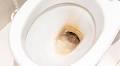 Toilet limescale vanishes after 1 flush if you use 1 common item that’s better than bleach