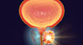 Prostate MRI solution OnQ Prostate launches on US market