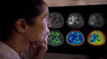 Philips teams with Synthetic MR for AI-enabled brain imaging