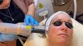 Luxe Rejuvena Aesthetics & Wellness – Laser Skin Resurfacing, Laser Hair Removal & Laser Tattoo Removal