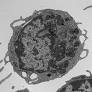 Beyond cell death: The hidden drivers of stem cell aging