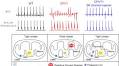 Pharmacological Enhancement of Small Conductance Ca2+-Activated K+ Channels Suppresses Cardiac Arrhythmias in a Mouse Model of Catecholaminergic Polymorphic Ventricular Tachycardia | Circulation Research