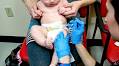 Study finds no link between aluminum in vaccines and autism, asthma