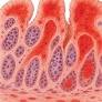 Appendectomy or JAK inhibitor in Active UC; Upadacitinib Benefit–Risk Profile