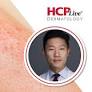 Key Takeaways on JAK Inhibitors and Black Box Warnings, With Eingun James Song, MD