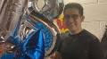 Laredo man burned on 80% of body; family seeks help for recovery