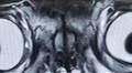 'Demon' pug MRI scan leaves people in stitches - but vets see a major issue