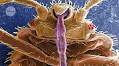 Bed bugs boomed as the world’s first cities did