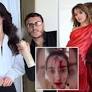Blood-covered beauty queen releases video of shocking aftermath following attack by celebrity stylist