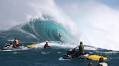 Billy Kemper, Gored By His Own Surfboard, Shares Graphic Footage That's Absolutely Gnarly