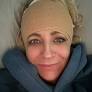 'Like a crime scene': Carrie Bickmore to undergo surgery after 'walking into a wall' in horror injury