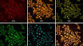 Three million images and morphological profiles of cells treated with matched chemical and genetic perturbations