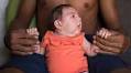 Which Infants Exposed to Zika Virus Infection in Pregnancy Should Have Eyes Examined