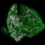 Texas A&M engineers illuminate cancer’s deadly hideout
