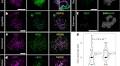 Meiotic recombination dynamics in plants with repeat-based holocentromeres shed light on the primary drivers of crossover patterning