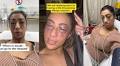 Influencer Films Severe Allergic Reaction That Left Her Unrecognizable