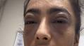 I could have died from my extreme nut allergy... medics tried to save me while I was making TikTok videos in hospital