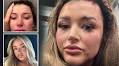 He punched me in back of the head - straight away I knew who my attacker was, says star on Dublin restaurant horror