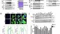 Function of eEF-1γ in the nucleus in response to insulin in hepatocellular carcinoma cells | Communications Biology