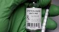 Common childhood virus linked to lupus disease in breakthrough study