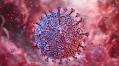 'Mono' Virus May Also Cause Lupus