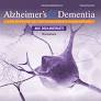 Diabetes and brain MRI measures: Results from SOL‐INCA MRI study