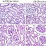 Metabonomic analysis of potential biomarkers and drug targets involved in diabetic nephropathy mice