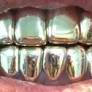 Com R$ 157 mil, Marco Feliciano teria todos seus dentes de ouro