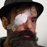 Yellow Vest leader hit in eye during protest 'handicapped for life', says lawyer