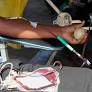 Observatório Cidadão para a Saúde denuncia negociatas de sangue nos hospitais