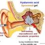 Hyaluronic acid liposomal gel sustains delivery of a corticoid to the inner ear