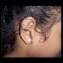 West Bengal: Girl bleeds from ear after teacher slaps her in class