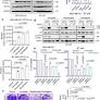LIFR inhibition enhances the therapeutic efficacy of HDAC inhibitors in triple negative breast cancer