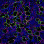 Suppression of thrombospondin-1–mediated inflammaging prolongs hematopoietic health span